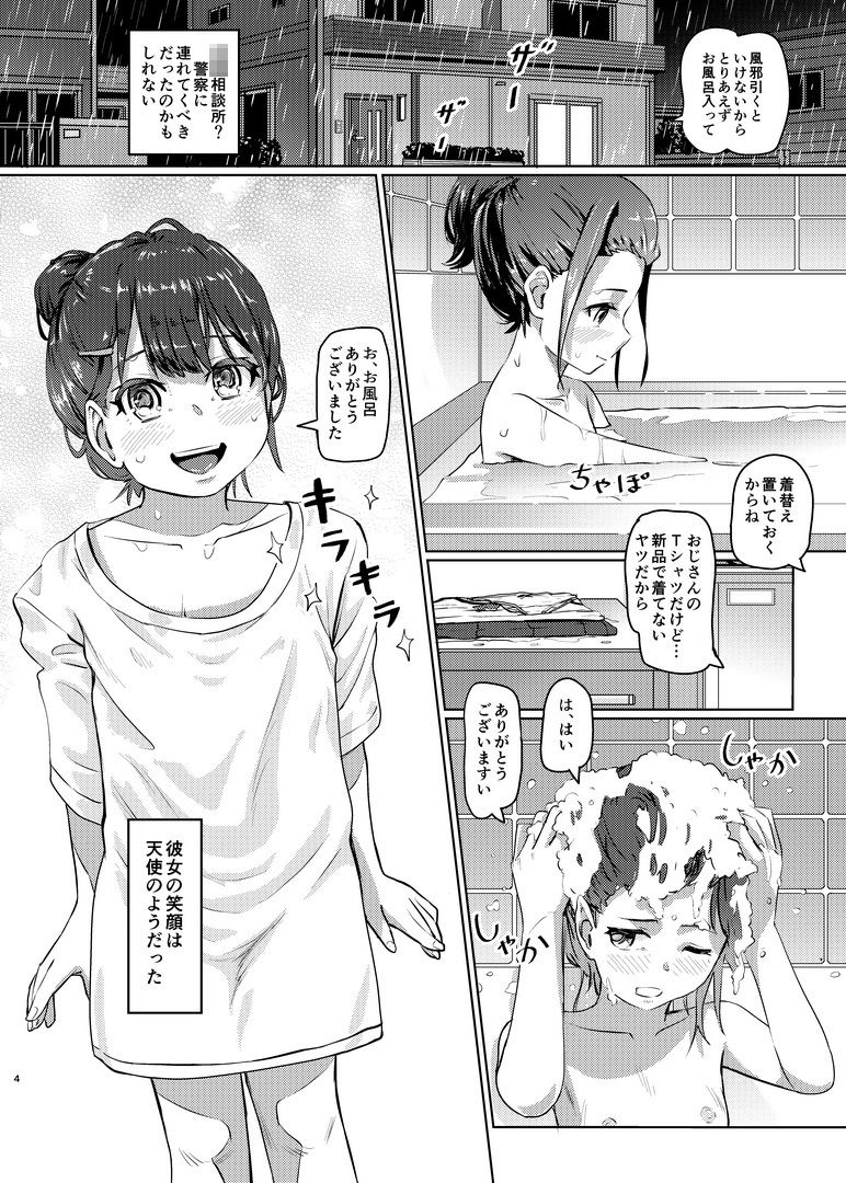 MIYU 1X。