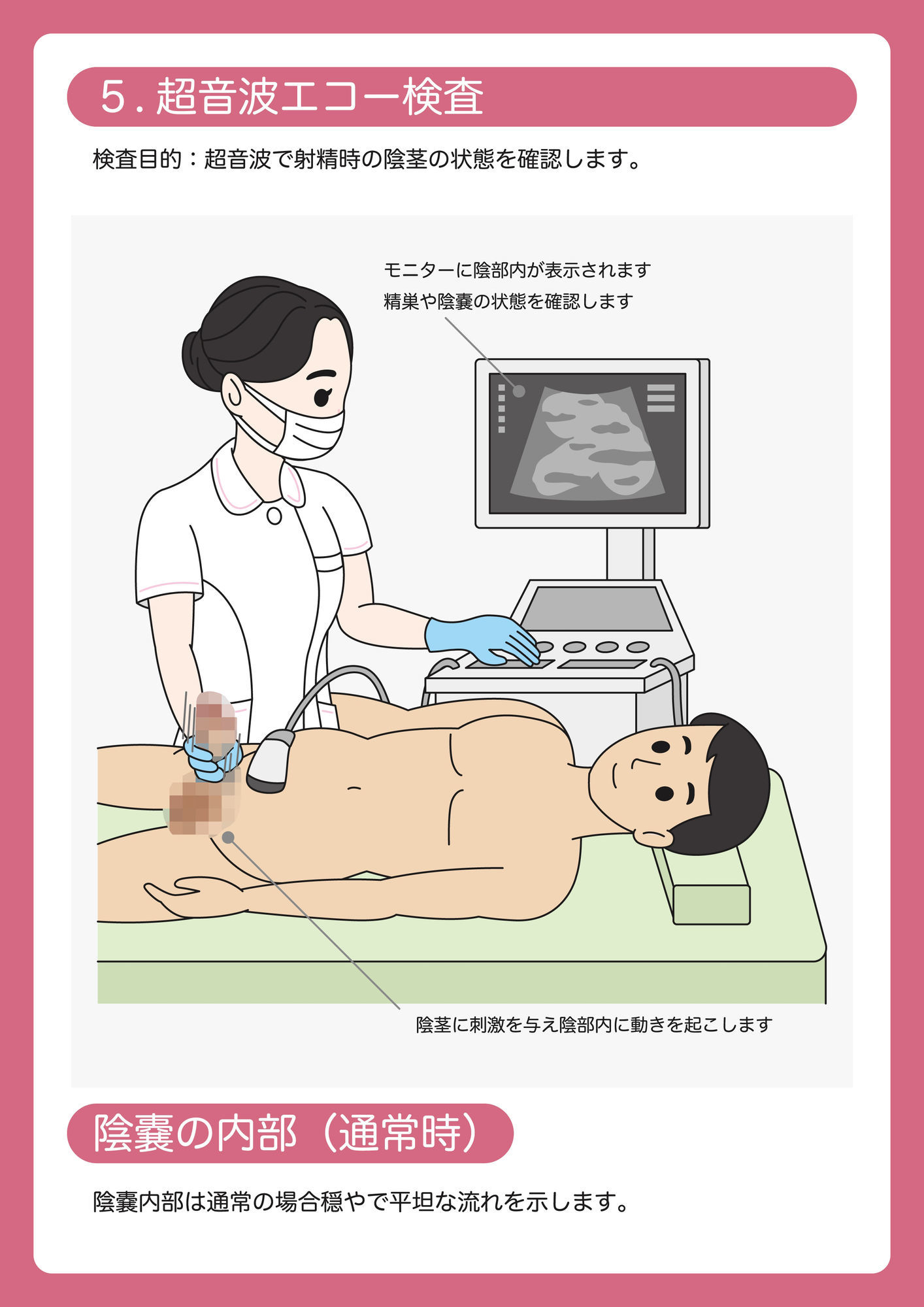 陰茎健診のご案内