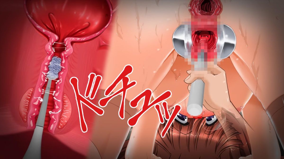 肉奴●志願〜100日間の拡張調教〜アニメーション全集
