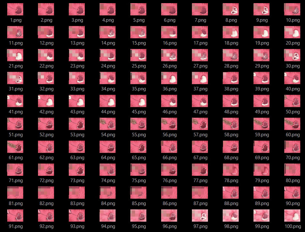 膣内断面図素材3