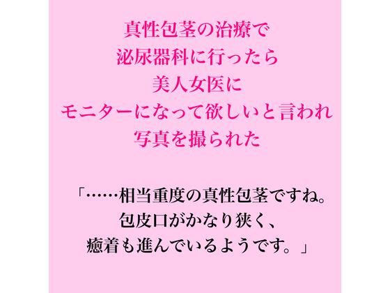 真性包茎の治療で泌尿器科に行ったら、美人女医にモニターになって欲しいと言われ写真を撮られた